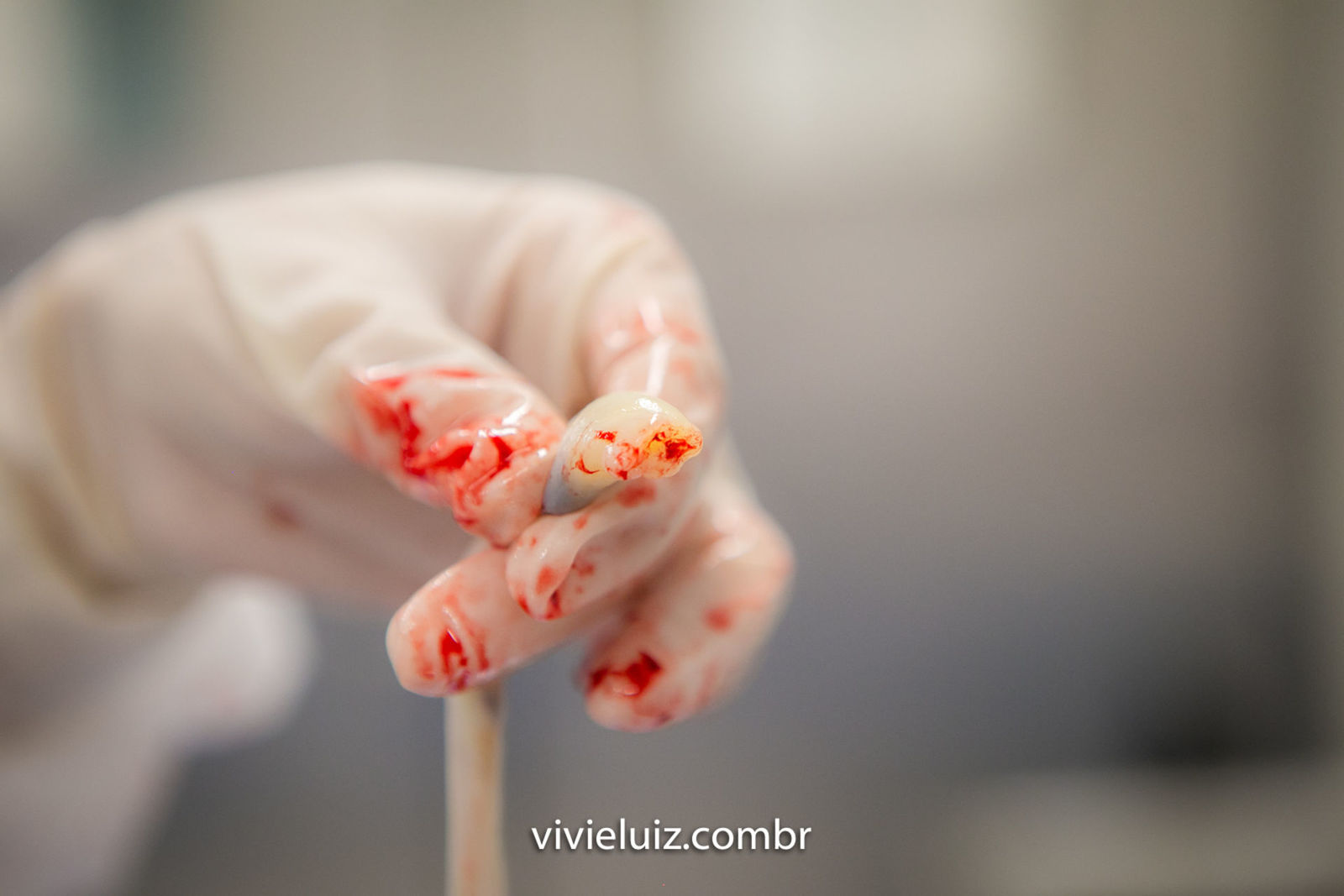 Foto Parto Luísa - Imagem 17